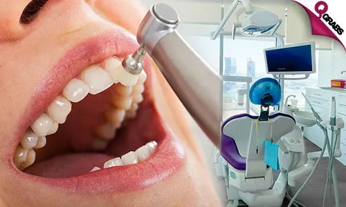 Teeth Scaling, Polishing, & Consultation!